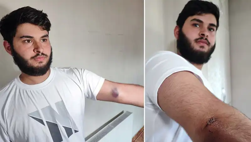 Mahallede Top Krizi! Conolar Kamyonetle Geldi, Olaylar Büyüdü